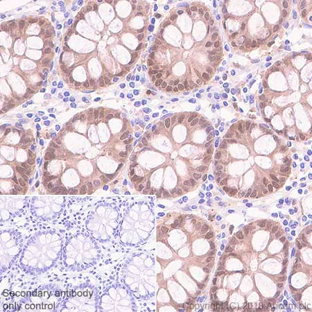 Immunohistochemistry (Formalin/PFA-fixed paraffin-embedded sections) - Anti-galectin 9/Gal-9 antibody [EPR22214] - Low endotoxin, Azide free (AB246797)