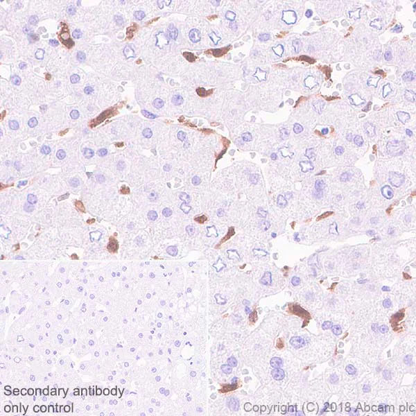 Immunohistochemistry (Formalin/PFA-fixed paraffin-embedded sections) - Anti-galectin 9/Gal-9 antibody [EPR22214] - Low endotoxin, Azide free (AB246797)