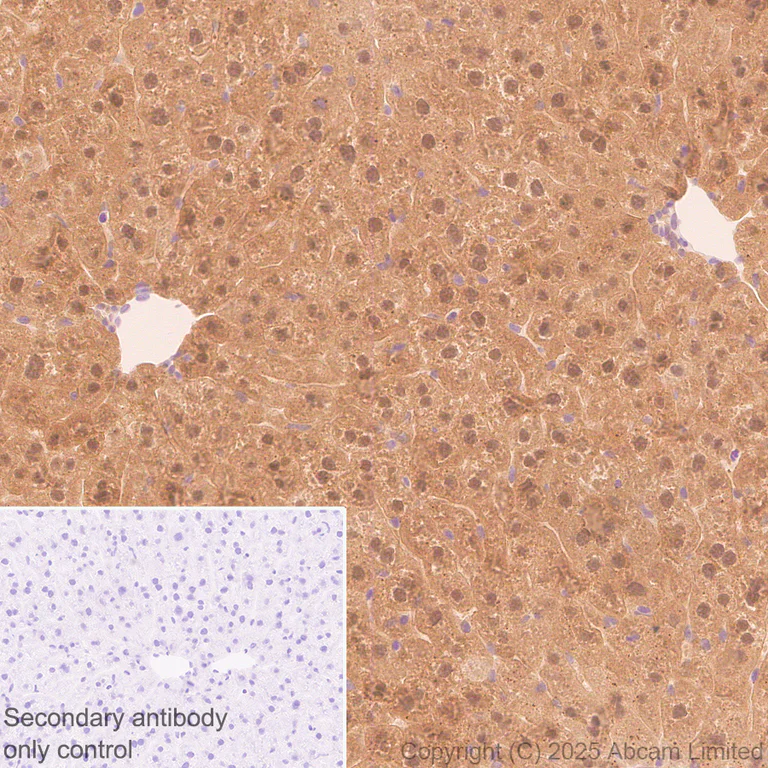 Immunohistochemistry (Formalin/PFA-fixed paraffin-embedded sections) - Anti-galectin 9/Gal-9 antibody [EPR29749-570] (AB325125)