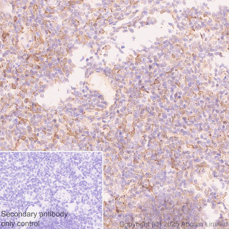 Immunohistochemistry (Formalin/PFA-fixed paraffin-embedded sections) - Anti-galectin 9/Gal-9 antibody [EPR29749-570] (AB325125)