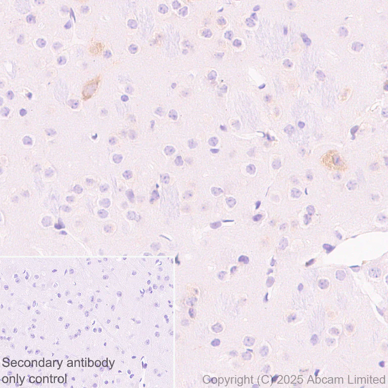 Immunohistochemistry (Formalin/PFA-fixed paraffin-embedded sections) - Anti-galectin 9/Gal-9 antibody [EPR29749-570] (AB325125)