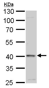 Western blot - Anti-GALK1 antibody (AB228533)
