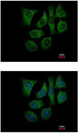 Immunocytochemistry/ Immunofluorescence - Anti-GALK2 antibody (AB153815)