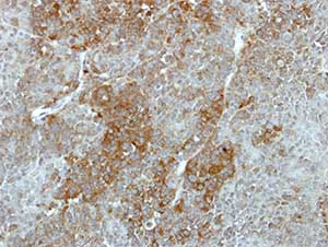 Immunohistochemistry (Formalin/PFA-fixed paraffin-embedded sections) - Anti-GALK2 antibody (AB153815)