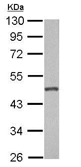Western blot - Anti-GALK2 antibody (AB153815)