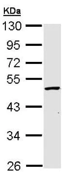 Western blot - Anti-GALK2 antibody (AB153815)