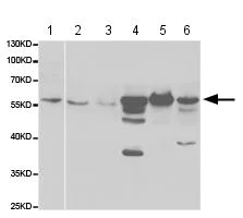 Western blot - Anti-GALNS/Chondroitinase antibody (AB187516)