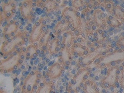 Immunohistochemistry (Formalin/PFA-fixed paraffin-embedded sections) - Anti-GALNS/Chondroitinase antibody (AB231647)