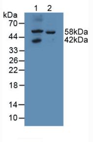 Western blot - Anti-GALNS/Chondroitinase antibody (AB231647)