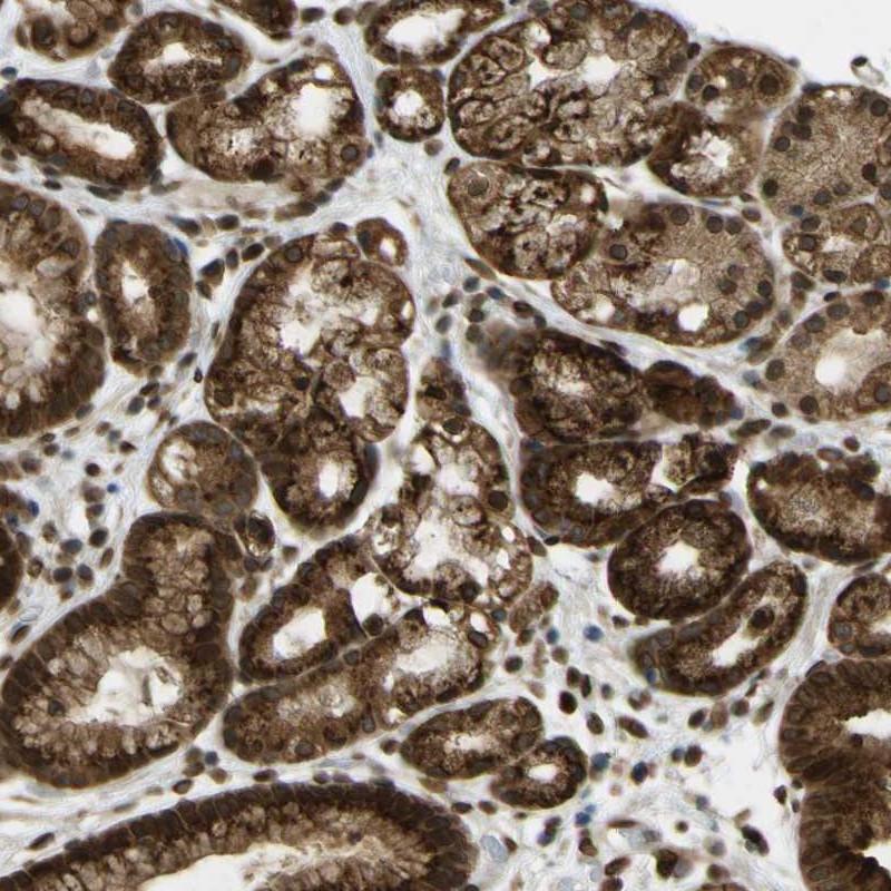 Immunohistochemistry (Formalin/PFA-fixed paraffin-embedded sections) - Anti-GALNT1 antibody (AB253025)