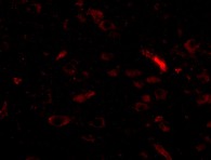 Immunocytochemistry/ Immunofluorescence - Anti-GALNT10 antibody (AB106471)