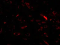 Immunocytochemistry/ Immunofluorescence - Anti-GALNT10 antibody (AB106471)