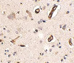 Immunohistochemistry (Formalin/PFA-fixed paraffin-embedded sections) - Anti-GALNT10 antibody (AB106471)