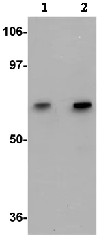 Western blot - Anti-GALNT10 antibody (AB106471)
