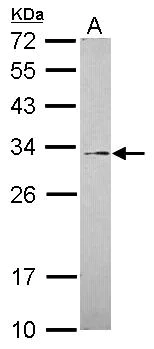 Western blot - Anti-GALNT12 antibody (AB101358)