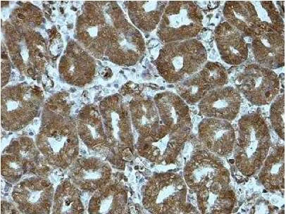 Immunohistochemistry (Formalin/PFA-fixed paraffin-embedded sections) - Anti-GALNT12 antibody (AB201196)