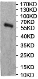 Western blot - Anti-GALNT12 antibody (AB201196)