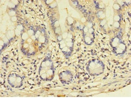 Immunohistochemistry (Formalin/PFA-fixed paraffin-embedded sections) - Anti-GALNT14 antibody (AB235526), expandable thumbnail