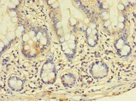 Immunohistochemistry (Formalin/PFA-fixed paraffin-embedded sections) - Anti-GALNT14 antibody (AB235526)