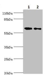 Western blot - Anti-GALNT14 antibody (AB235526)