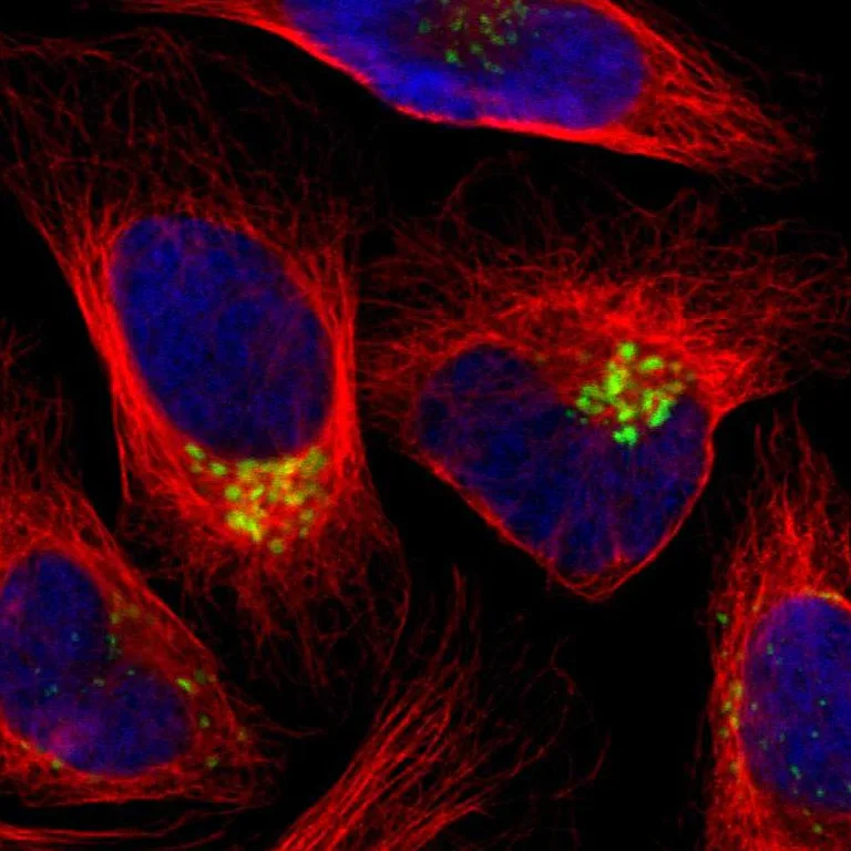Immunocytochemistry/ Immunofluorescence - Anti-GALNT2 antibody (AB262868)