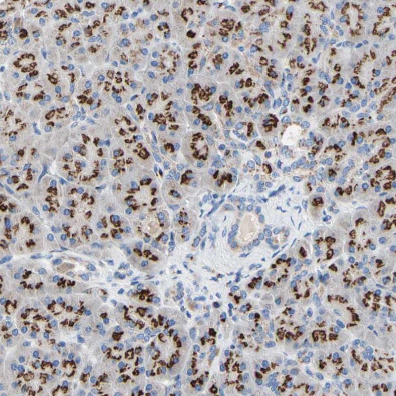 Immunohistochemistry (Formalin/PFA-fixed paraffin-embedded sections) - Anti-GALNT2 antibody (AB262868)