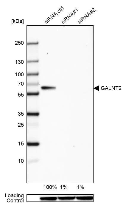 Western blot - Anti-GALNT2 antibody (AB262868)