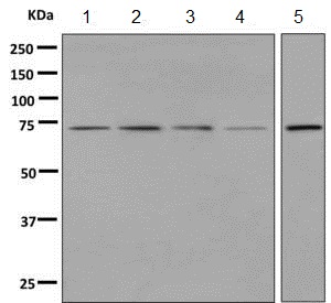Western blot - Anti-GALNT2 antibody [EPR9605(B)] - BSA and Azide free (AB248920), expandable thumbnail