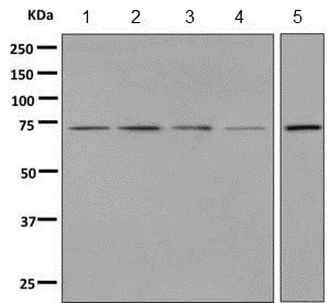 Western blot - Anti-GALNT2 antibody [EPR9605(B)] - BSA and Azide free (AB248920)