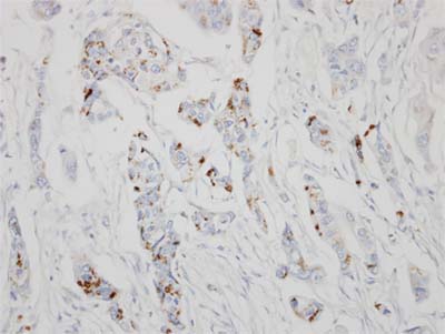 Immunohistochemistry (Formalin/PFA-fixed paraffin-embedded sections) - Anti-GALNT6 antibody (AB151329), expandable thumbnail