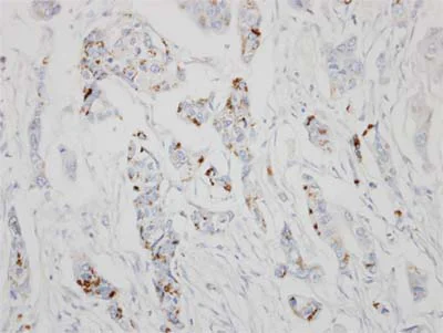 Immunohistochemistry (Formalin/PFA-fixed paraffin-embedded sections) - Anti-GALNT6 antibody (AB151329)
