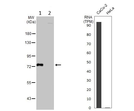Western blot - Anti-GALNT6 antibody (AB151329)