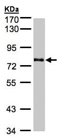 Western blot - Anti-GALNT6 antibody (AB151329), expandable thumbnail