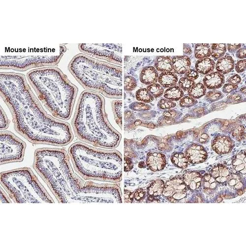 Immunohistochemistry (Formalin/PFA-fixed paraffin-embedded sections) - Anti-GALNT6 antibody [HL2392] (AB317215)