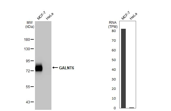 Western blot - Anti-GALNT6 antibody [HL2392] (AB317215)