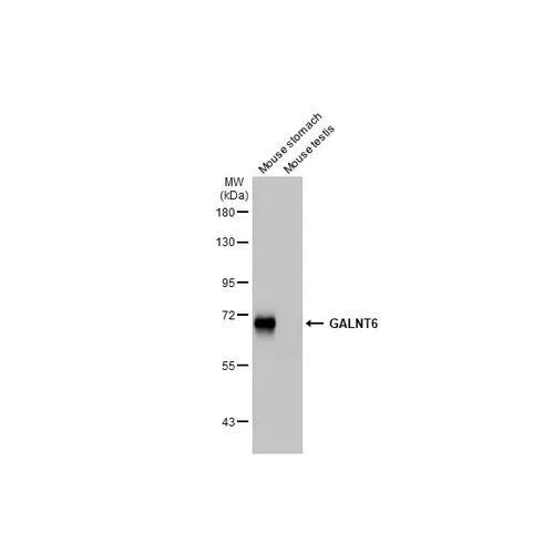 Western blot - Anti-GALNT6 antibody [HL2392] (AB317215)
