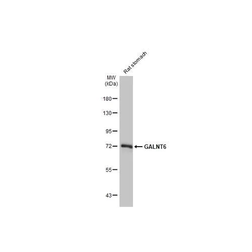 Western blot - Anti-GALNT6 antibody [HL2392] (AB317215)