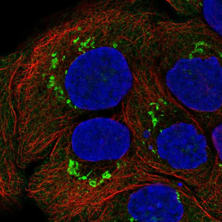 Immunocytochemistry/ Immunofluorescence - Anti-GALNT7 antibody (AB254971)