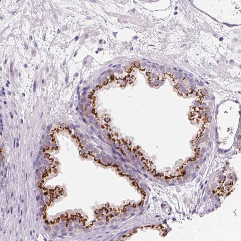 Immunohistochemistry (Formalin/PFA-fixed paraffin-embedded sections) - Anti-GALNT7 antibody (AB254971)