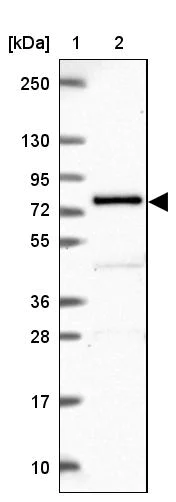 Western blot - Anti-GALNT7 antibody (AB254971)