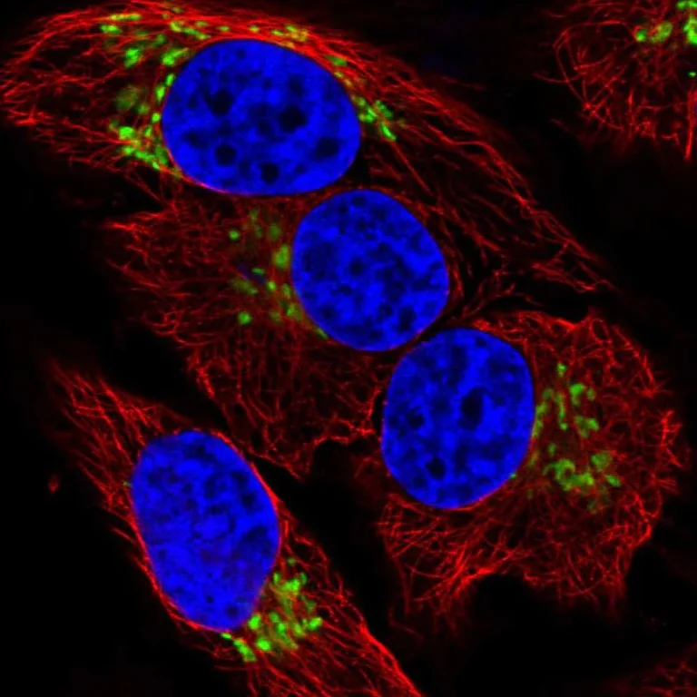 Immunocytochemistry/ Immunofluorescence - Anti-GALNT7 antibody (AB254975)