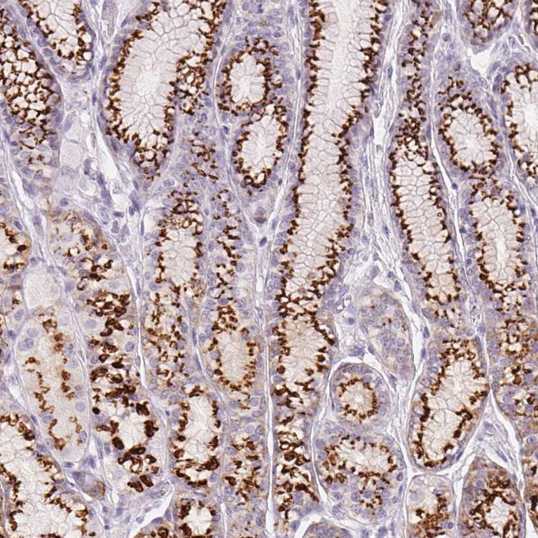 Immunohistochemistry (Formalin/PFA-fixed paraffin-embedded sections) - Anti-GALNT7 antibody (AB254975)