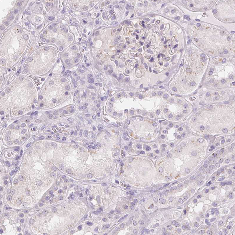 Immunohistochemistry (Formalin/PFA-fixed paraffin-embedded sections) - Anti-GALNT7 antibody (AB254975)