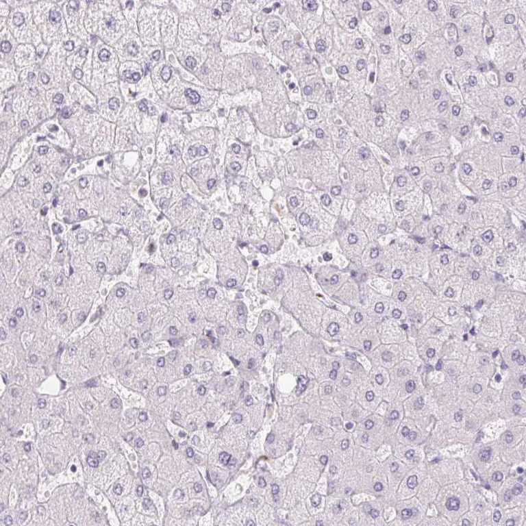 Immunohistochemistry (Formalin/PFA-fixed paraffin-embedded sections) - Anti-GALNT7 antibody (AB254975)