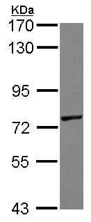 Western blot - Anti-GALNT7 antibody (AB97645), expandable thumbnail