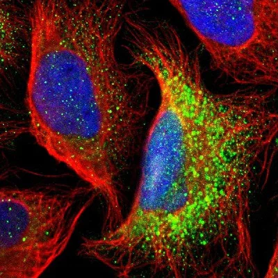 Immunocytochemistry/ Immunofluorescence - Anti-GALNT8 antibody (AB121374)
