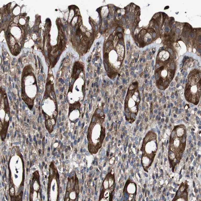Immunohistochemistry (Formalin/PFA-fixed paraffin-embedded sections) - Anti-GALNT8 antibody (AB121374)