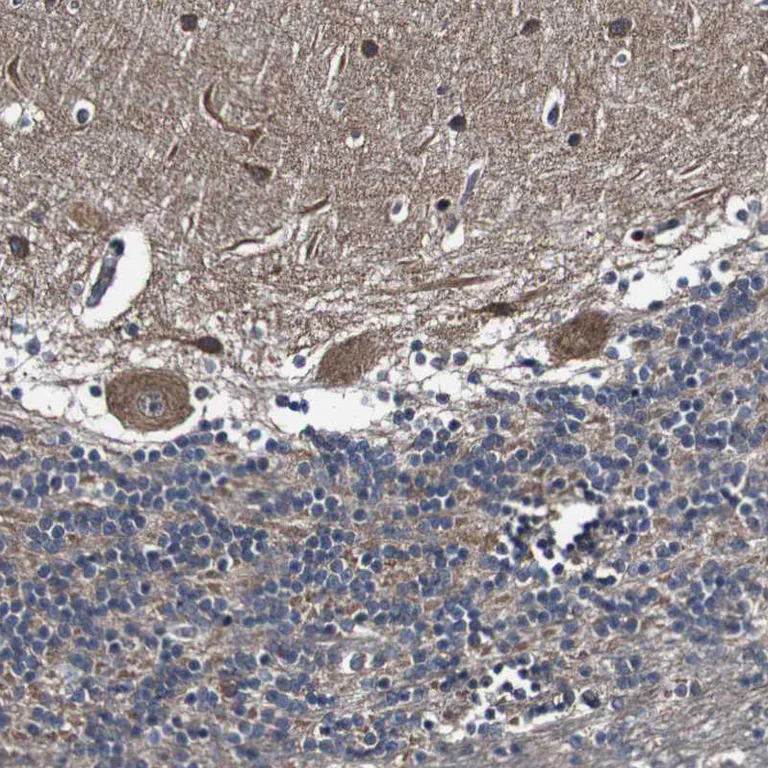 Immunohistochemistry (Formalin/PFA-fixed paraffin-embedded sections) - Anti-GALNT8 antibody (AB121374)