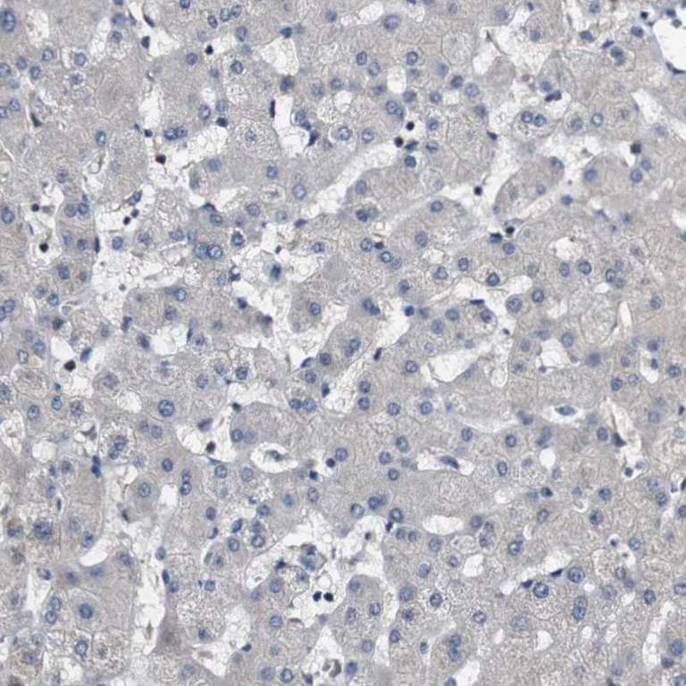 Immunohistochemistry (Formalin/PFA-fixed paraffin-embedded sections) - Anti-GALNT8 antibody (AB121374)
