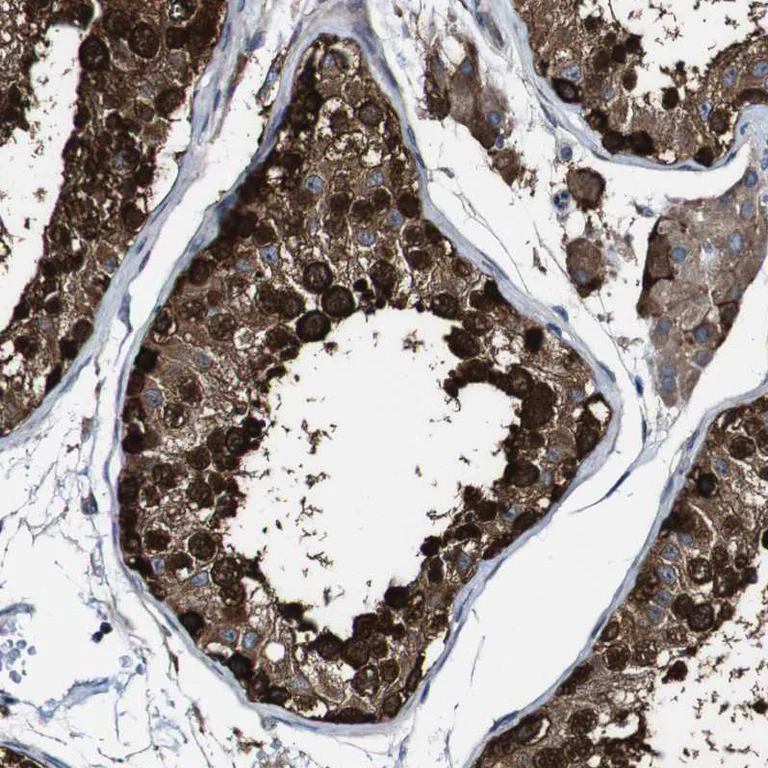 Immunohistochemistry (Formalin/PFA-fixed paraffin-embedded sections) - Anti-GALNT8 antibody (AB121374)